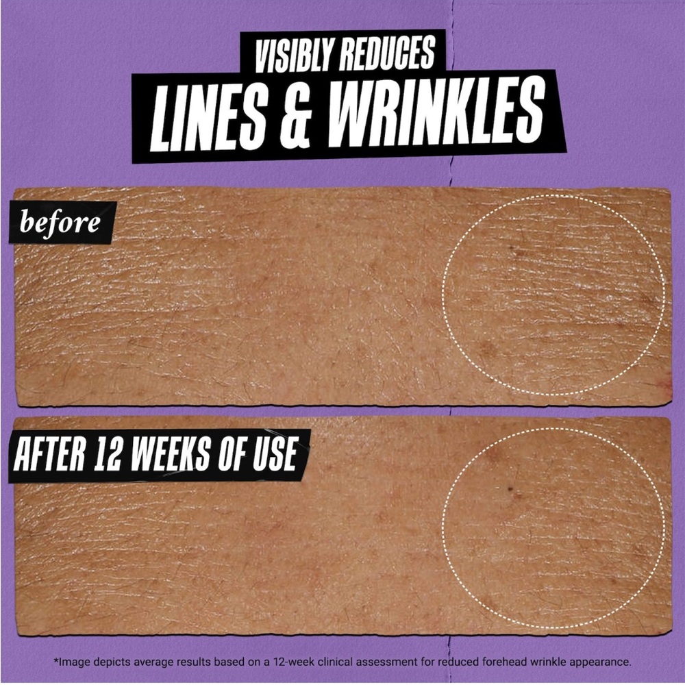 Kiehl’s Retinol Skin Renewing Daily Micro-Dose Serum 1 fl.oz NWOB - Picture 4 of 10